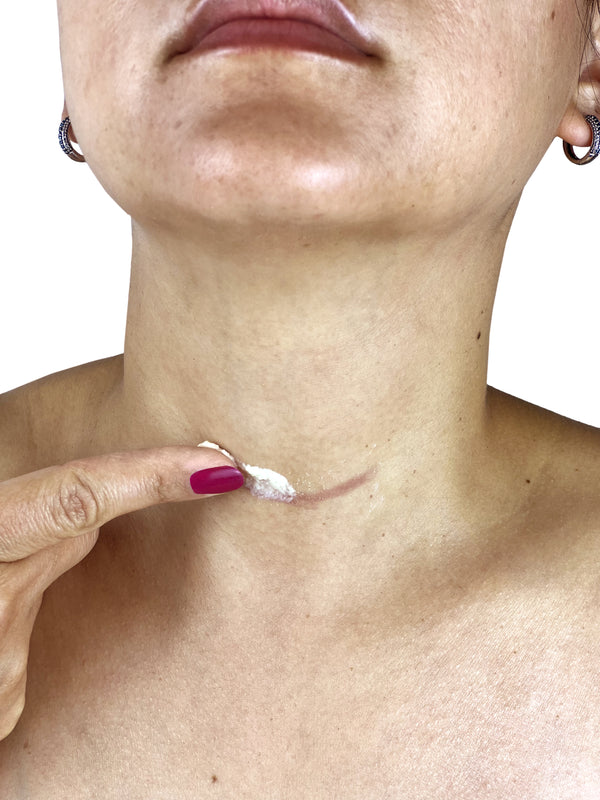 ThyroidScar Rx: The Premiere Scar Management System